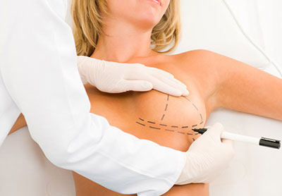  جراحی کوچک کردن سینه