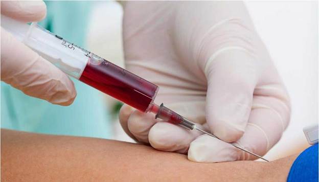 نمونه گیری خون در محل